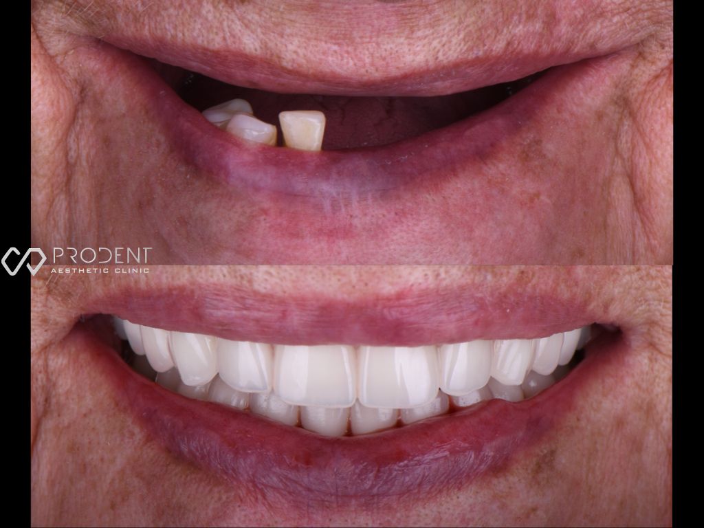 Ulises Pérez Murillo-76