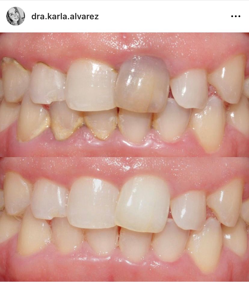 Karla Alvarez Treviño-15