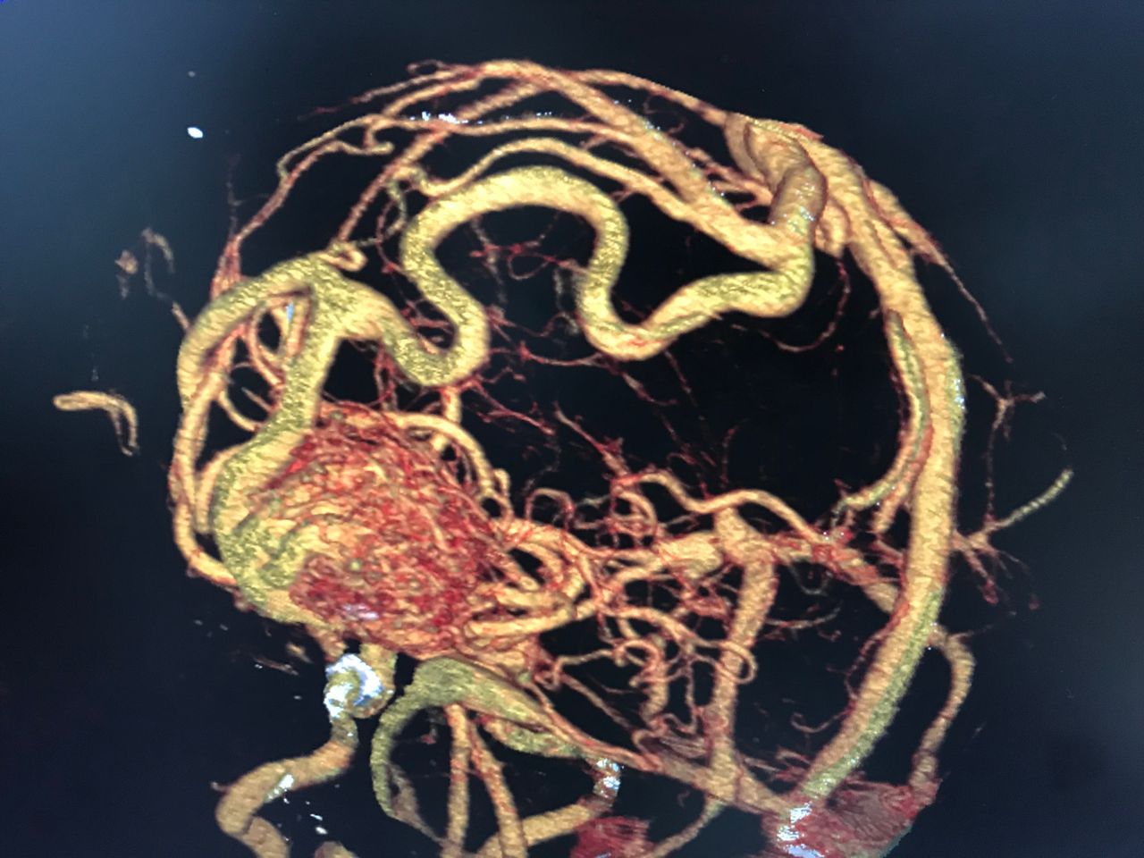 Rafael Maciel Morfin-45