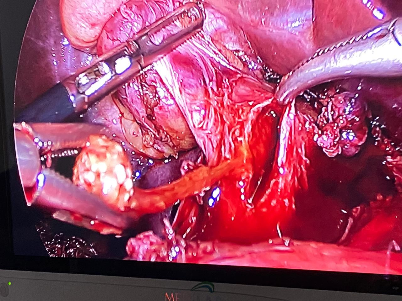 Diego Edwuin Rosales Carmona-17