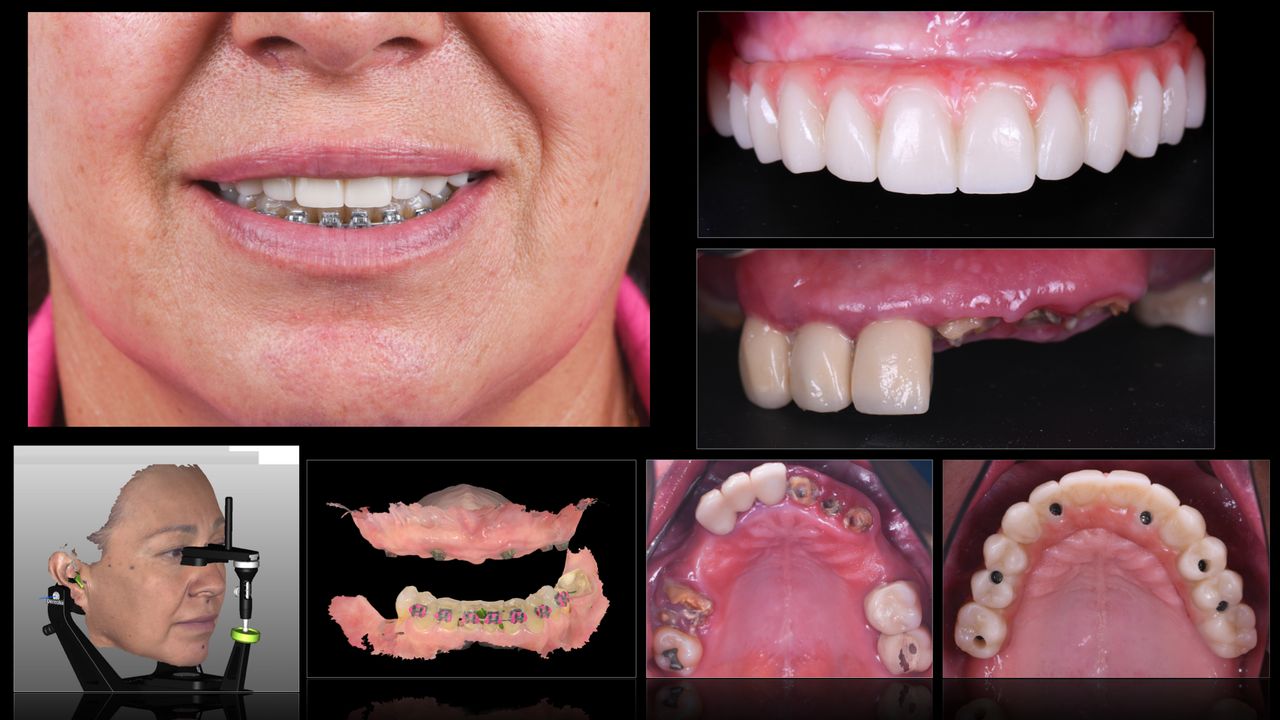 Ricardo López Lemus-6