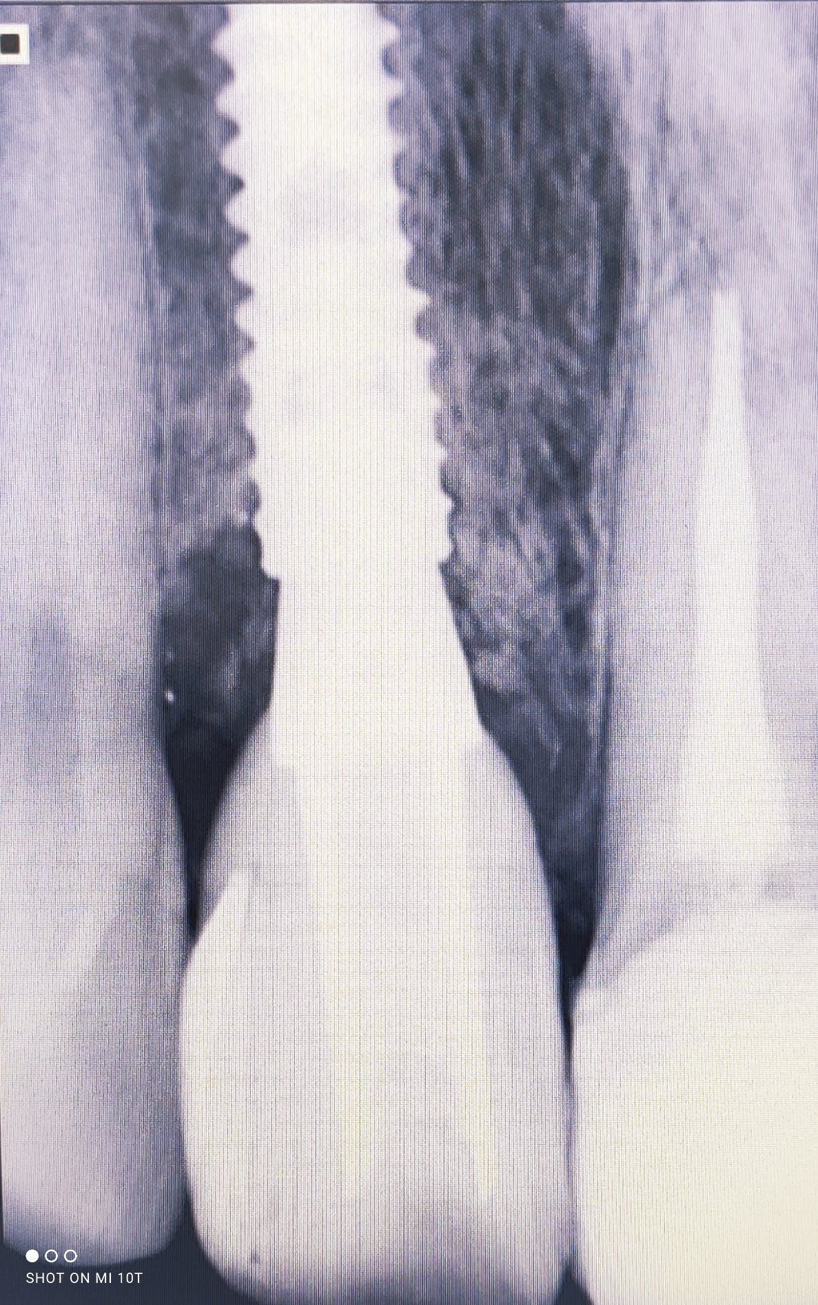 Edgar Antonio Zavala Alvarado-6