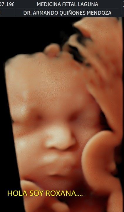 Armando Quiñones Mendoza-11