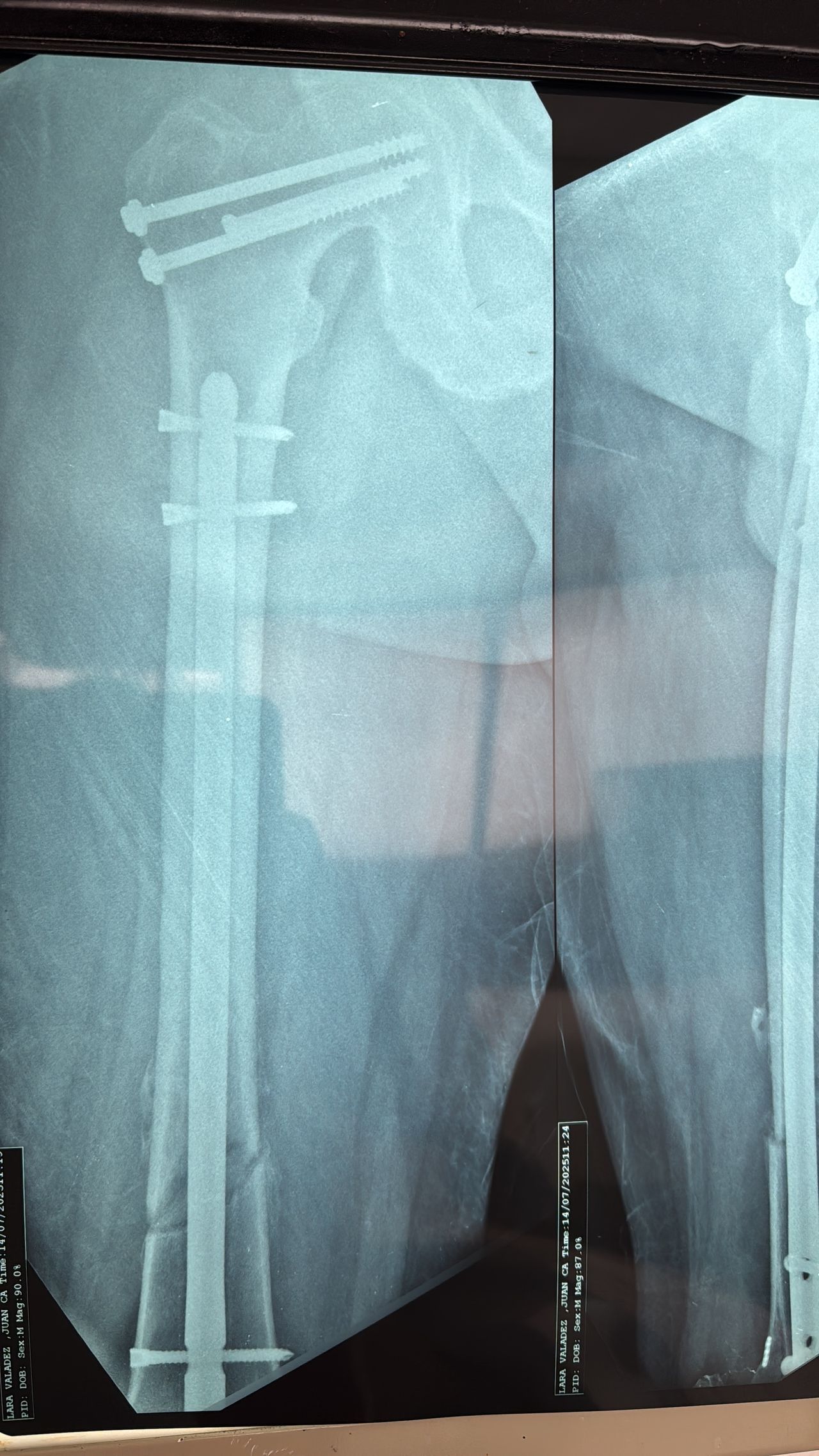 Max Georges Sainte Bernal-4