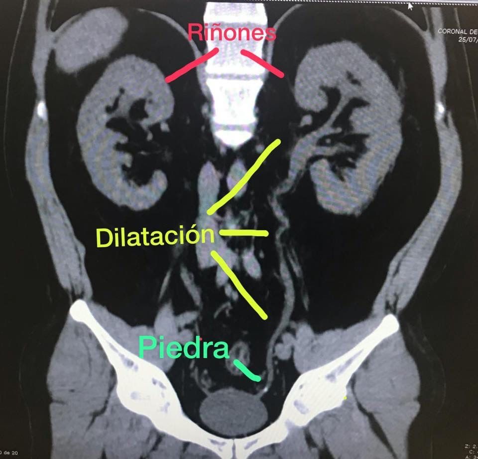 Juan Manuel Mendoza Muñiz-19