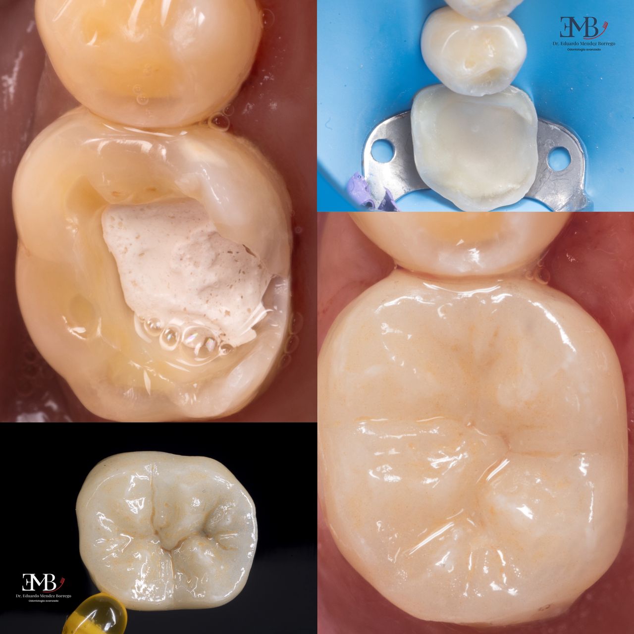 Hervin Eduardo Mendez Borrego-25