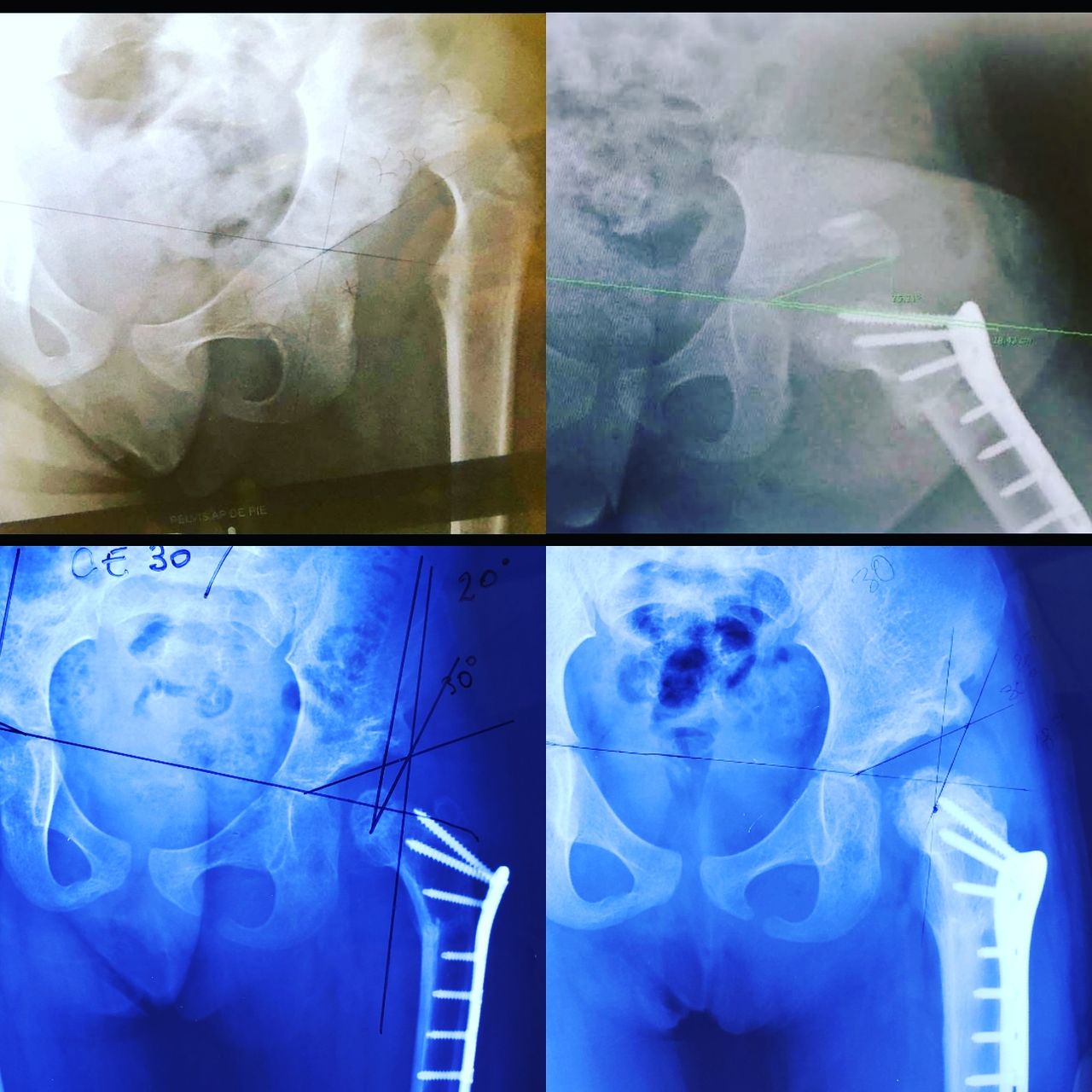 Alfonso Meza Vernis-71