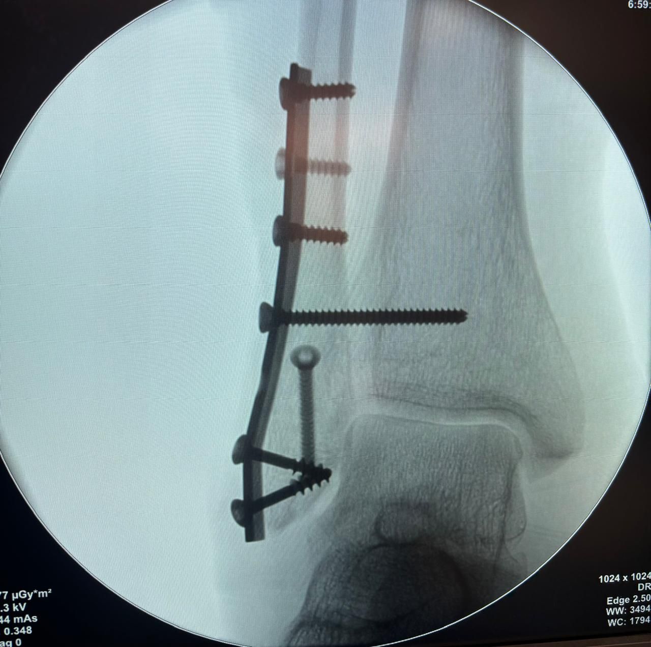 Juan Pedro Martínez Ávila-8