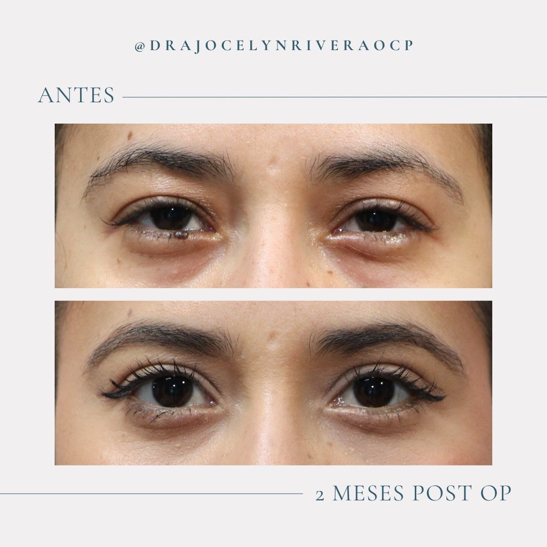 Ivonne Jocelyn Rivera Alvarado-5