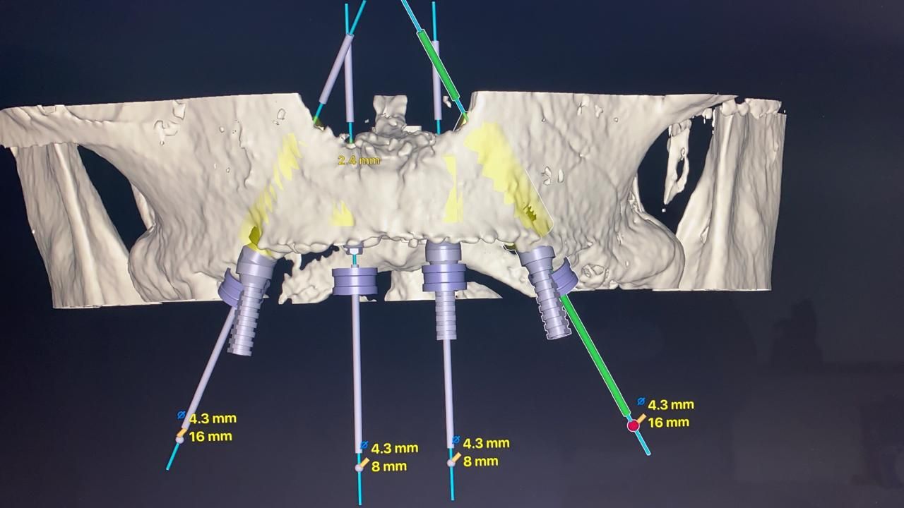 Alberto Wintergerst Fisch-30