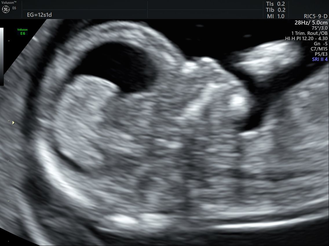 Guillermo Abrego Rodríguez-10