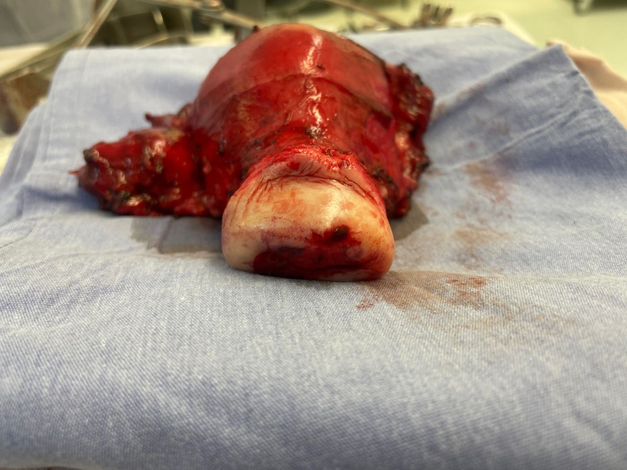 Christian Samuel Uitzil Colli-13