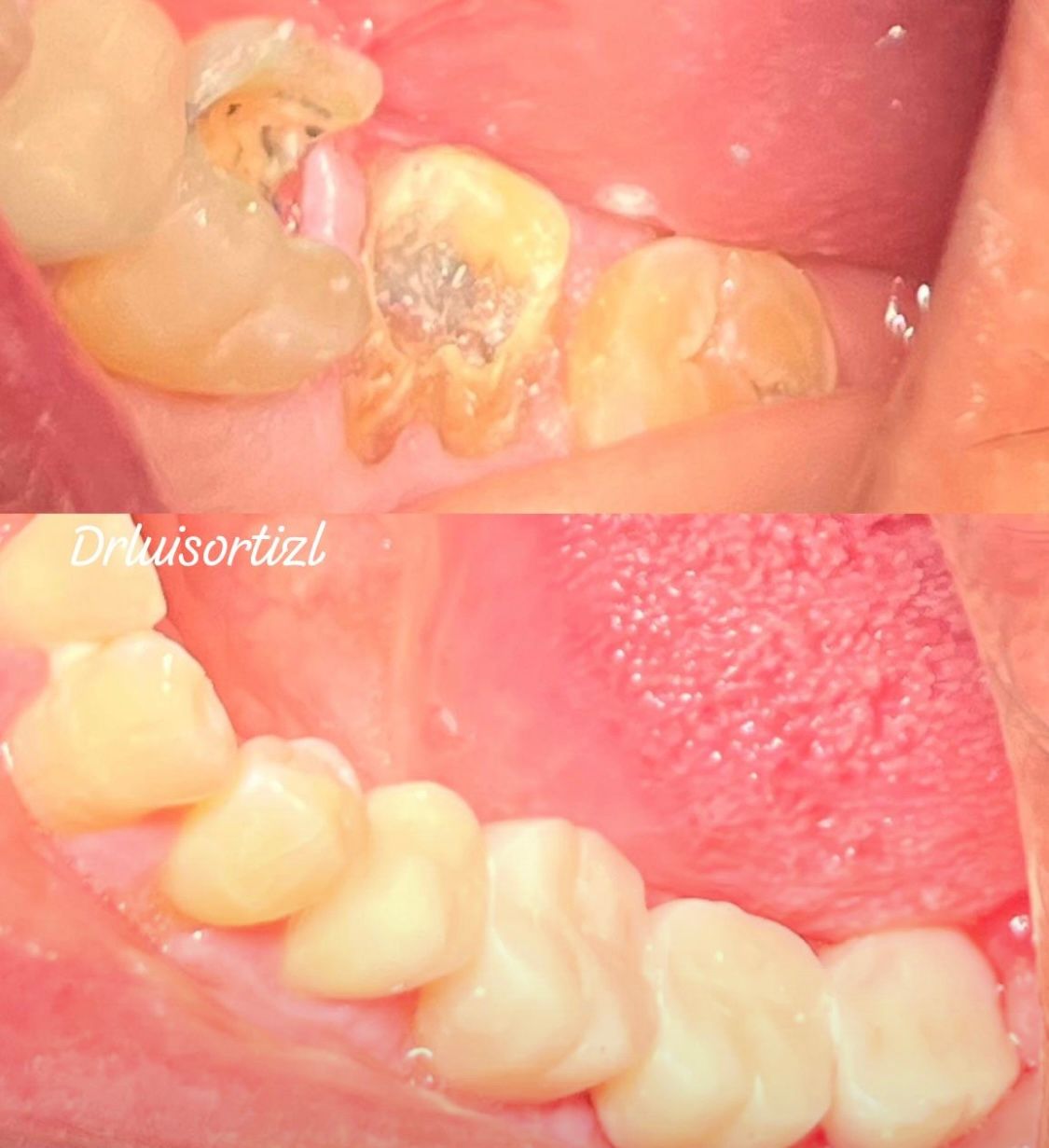 Luis Ángel Ortiz López-22