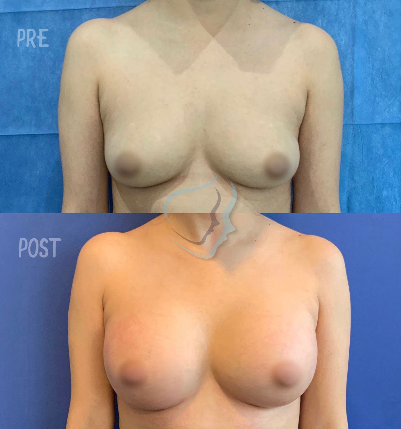 Giuseppe Tanzillo-50