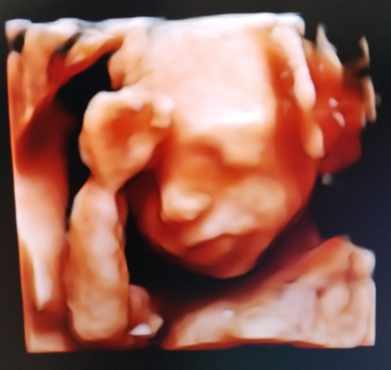 Iván André Guzmán Amador-1