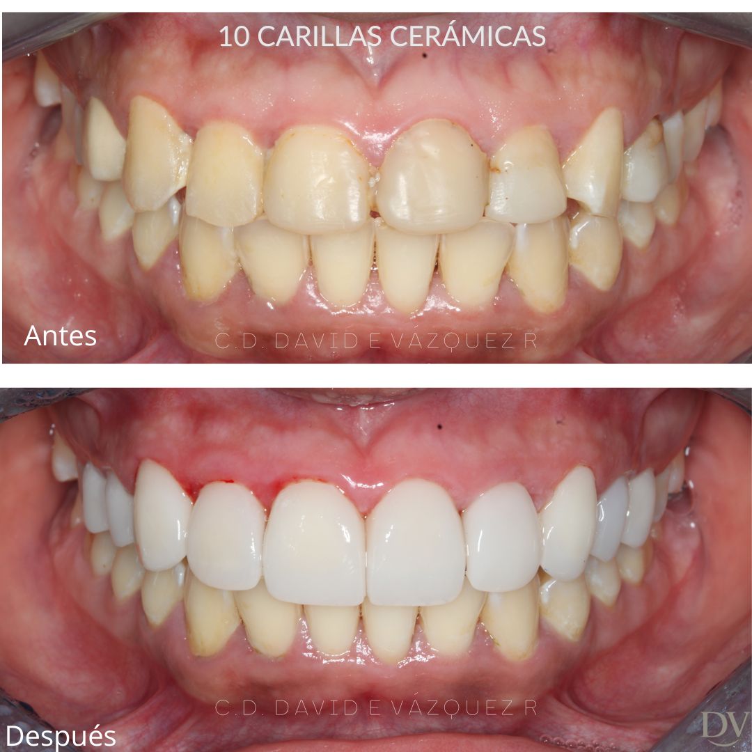 David Emmanuel Vázquez Rosas-2