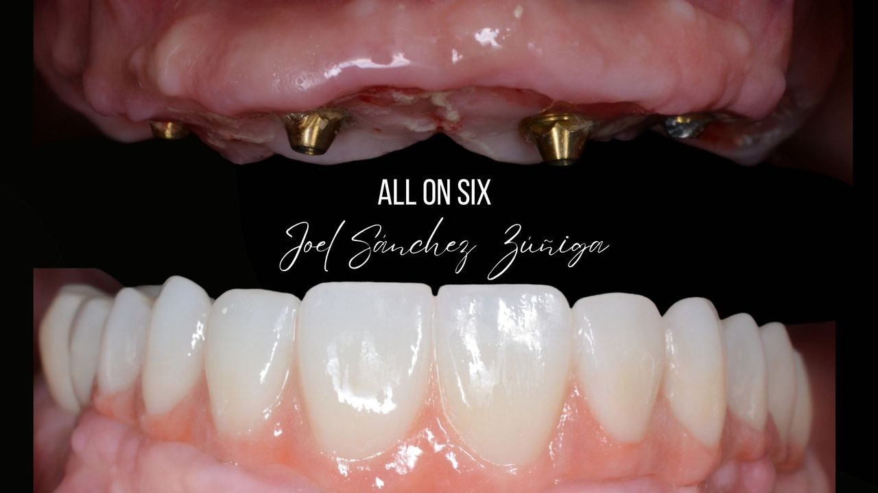 Joel Alejandro Sánchez Zúñiga-4