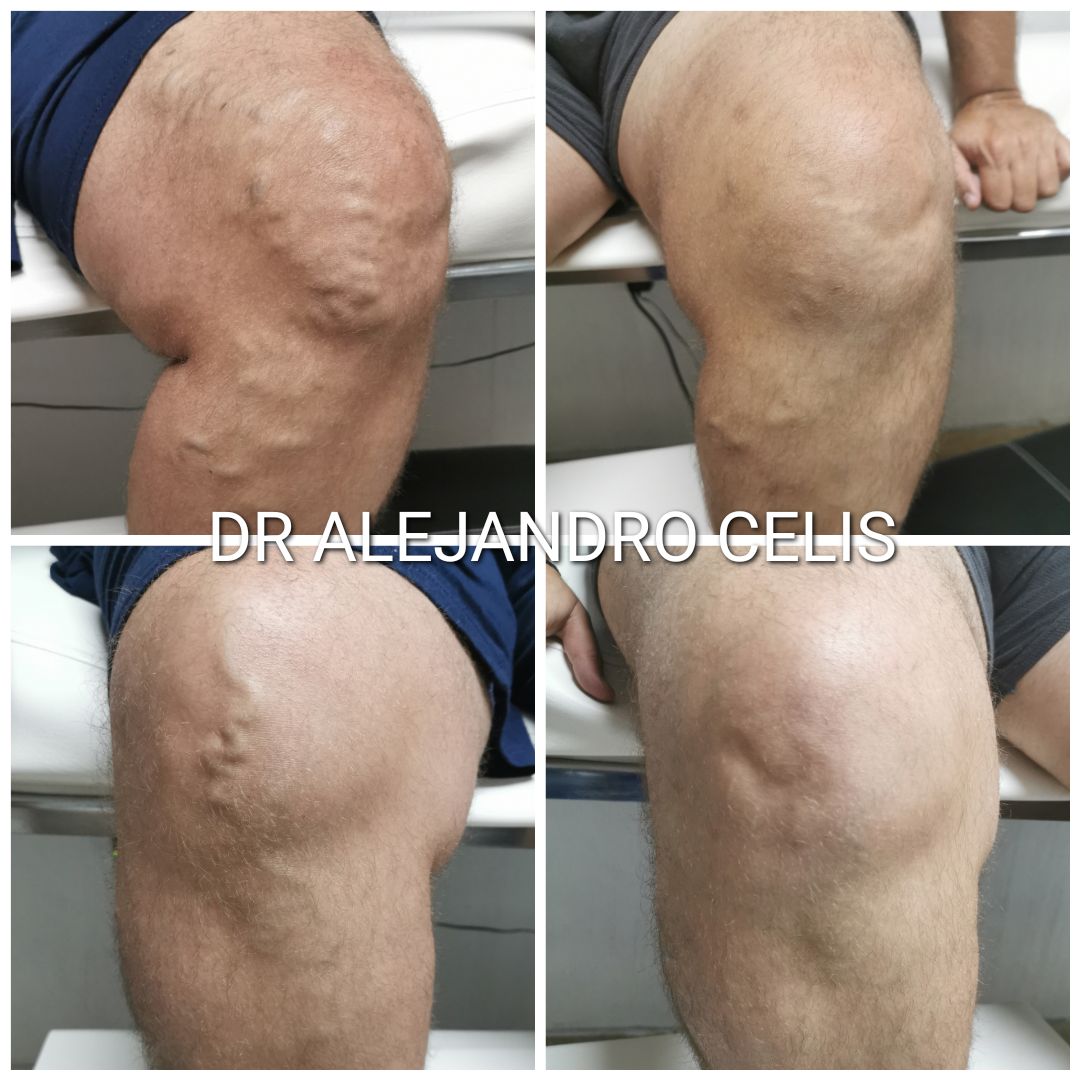 Alejandro Celis Jiménez-12