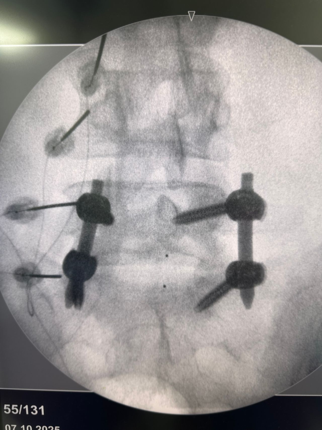 Alonso Cantú Martínez-7