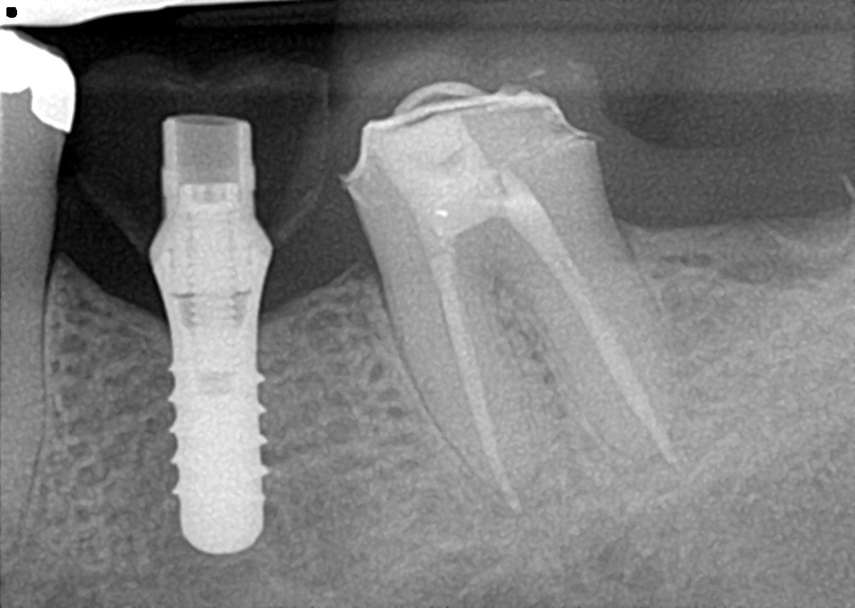 Ricardo López Lemus-80