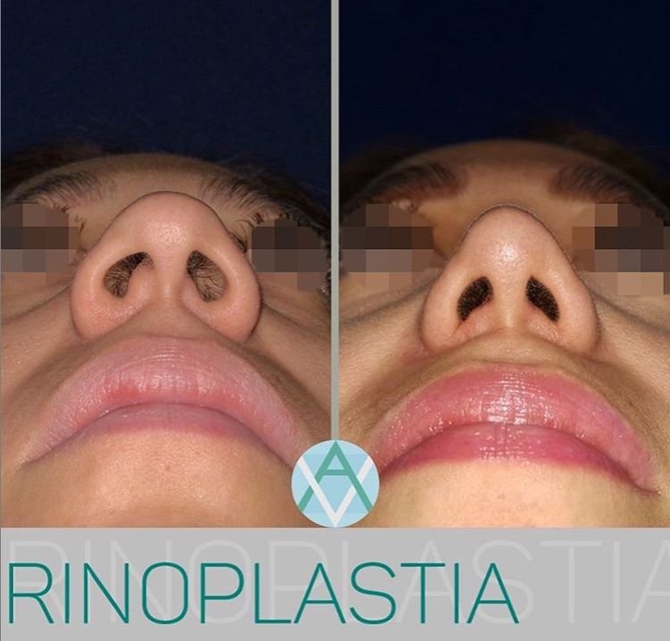 Alfonso Villaseñor Herrero-22