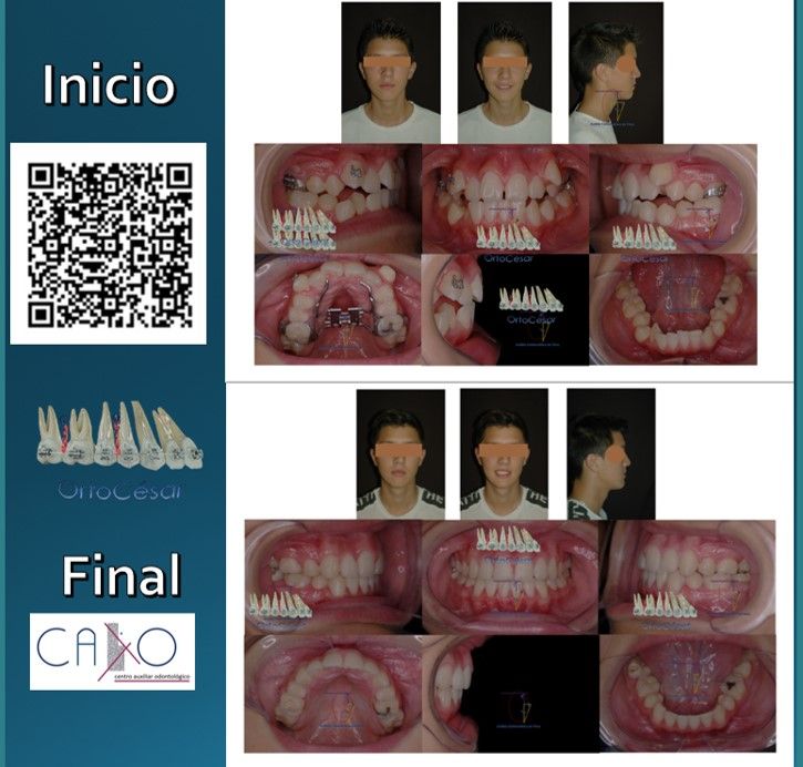 César Augusto Pérez Córdova-6