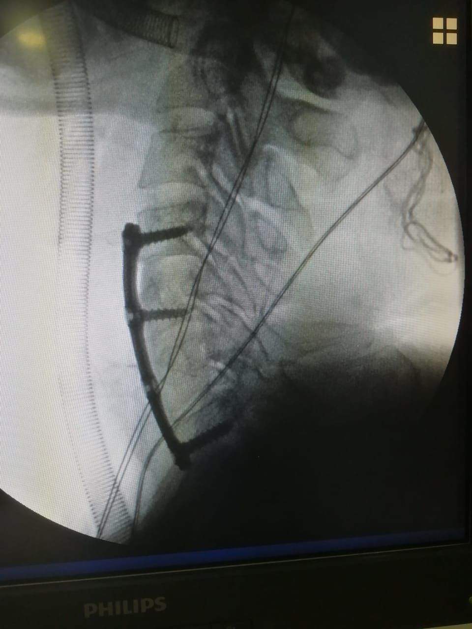 Juan José Luévano De La Cruz-36