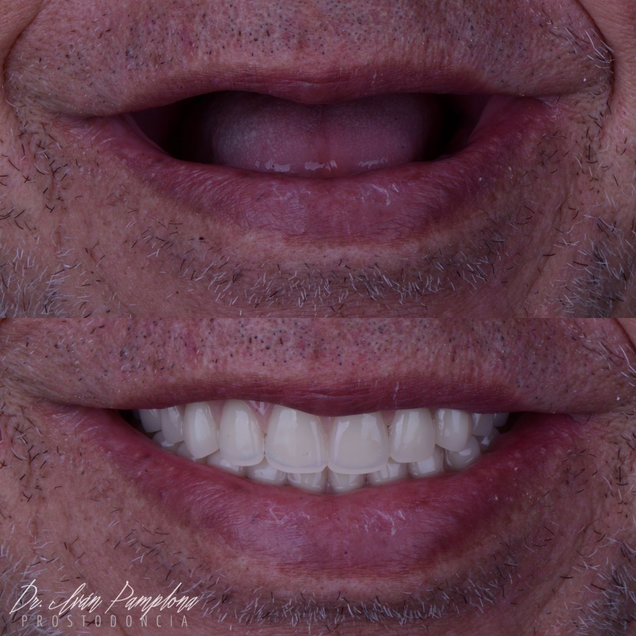 Iván Gerardo Pamplona Alfaro-15