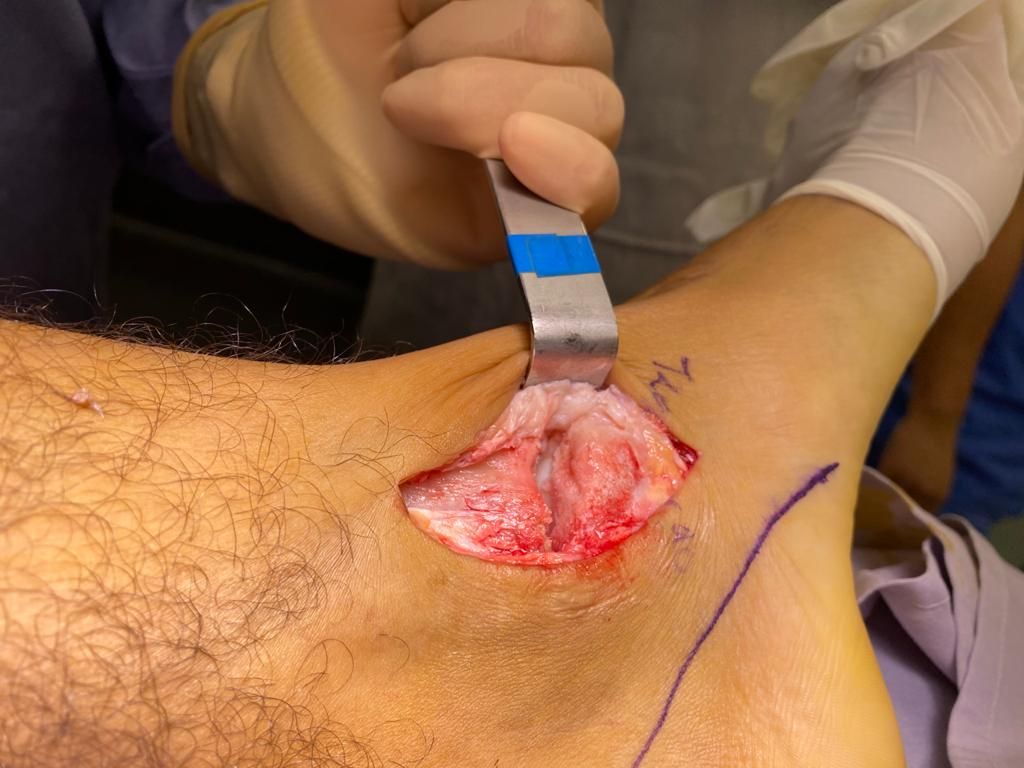 Alberto Lorenzo Cortés-22