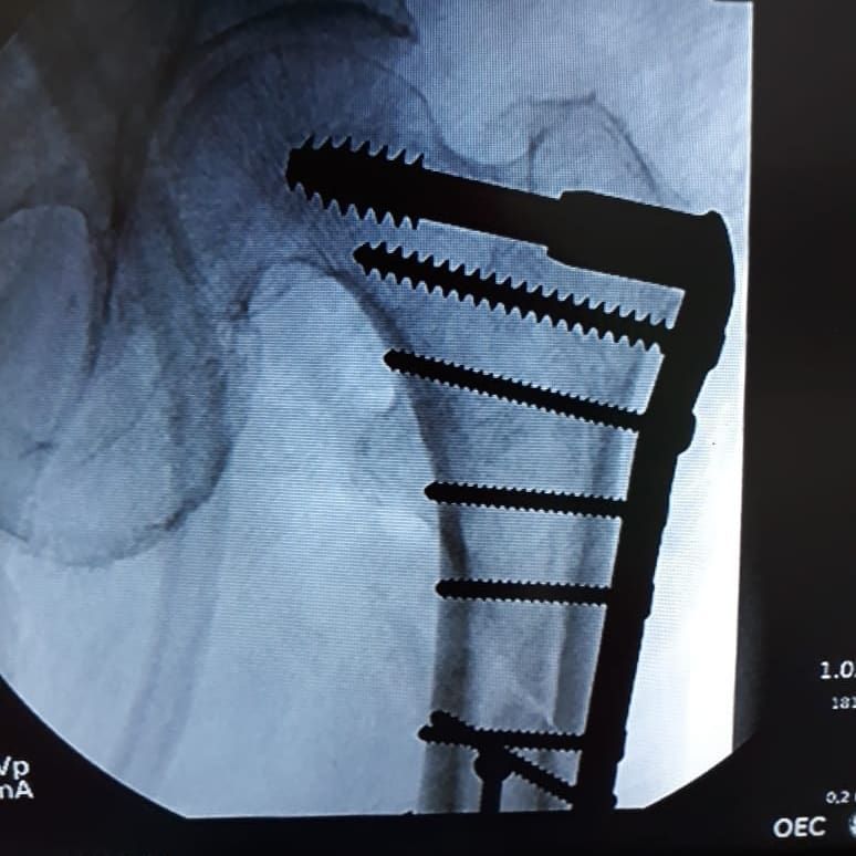 Carlos Humberto Vera Torres-18