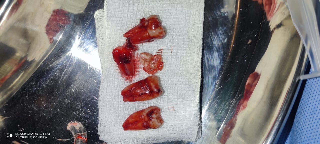 Jonathan Manuel Morán Castell-25