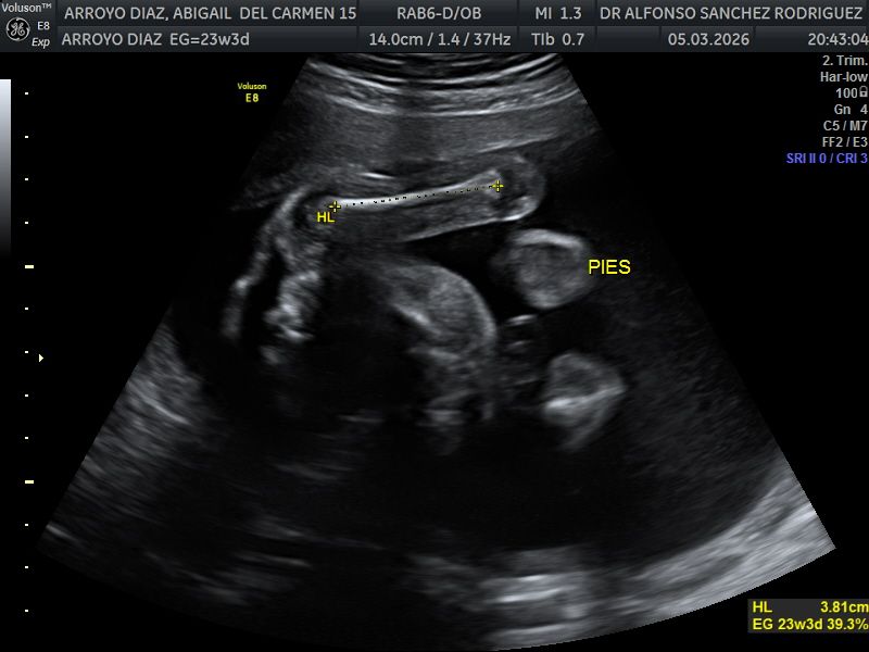 Alfonso Sanchez Rodriguez-66