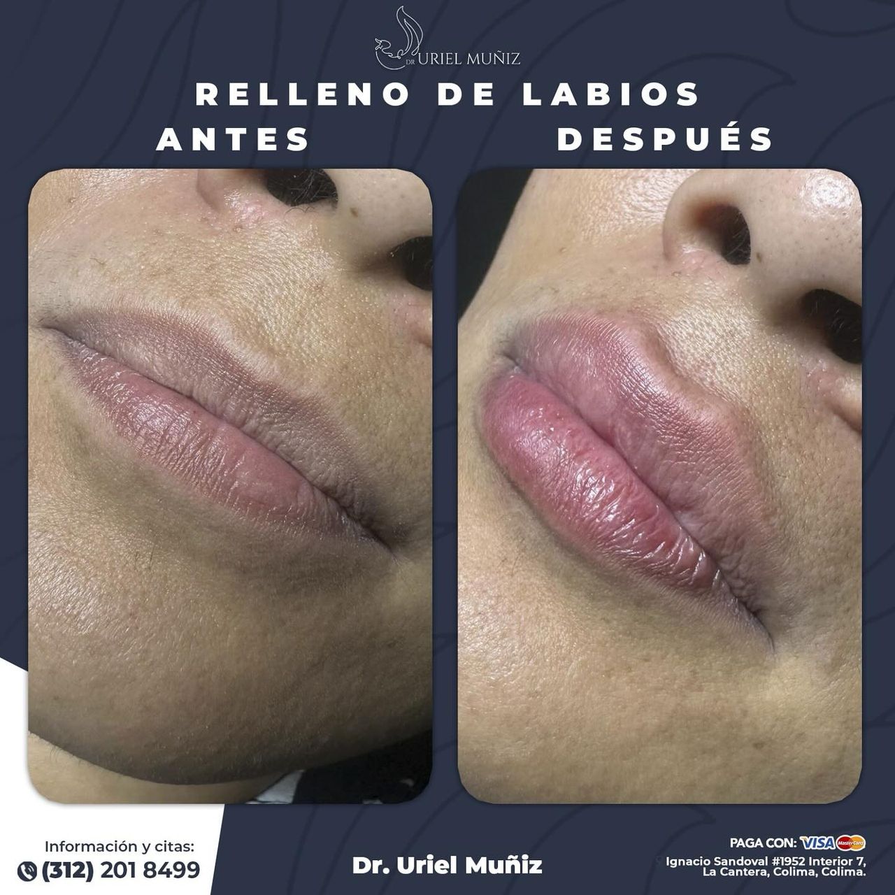 Teófilo Uriel Muñiz Chávez-5