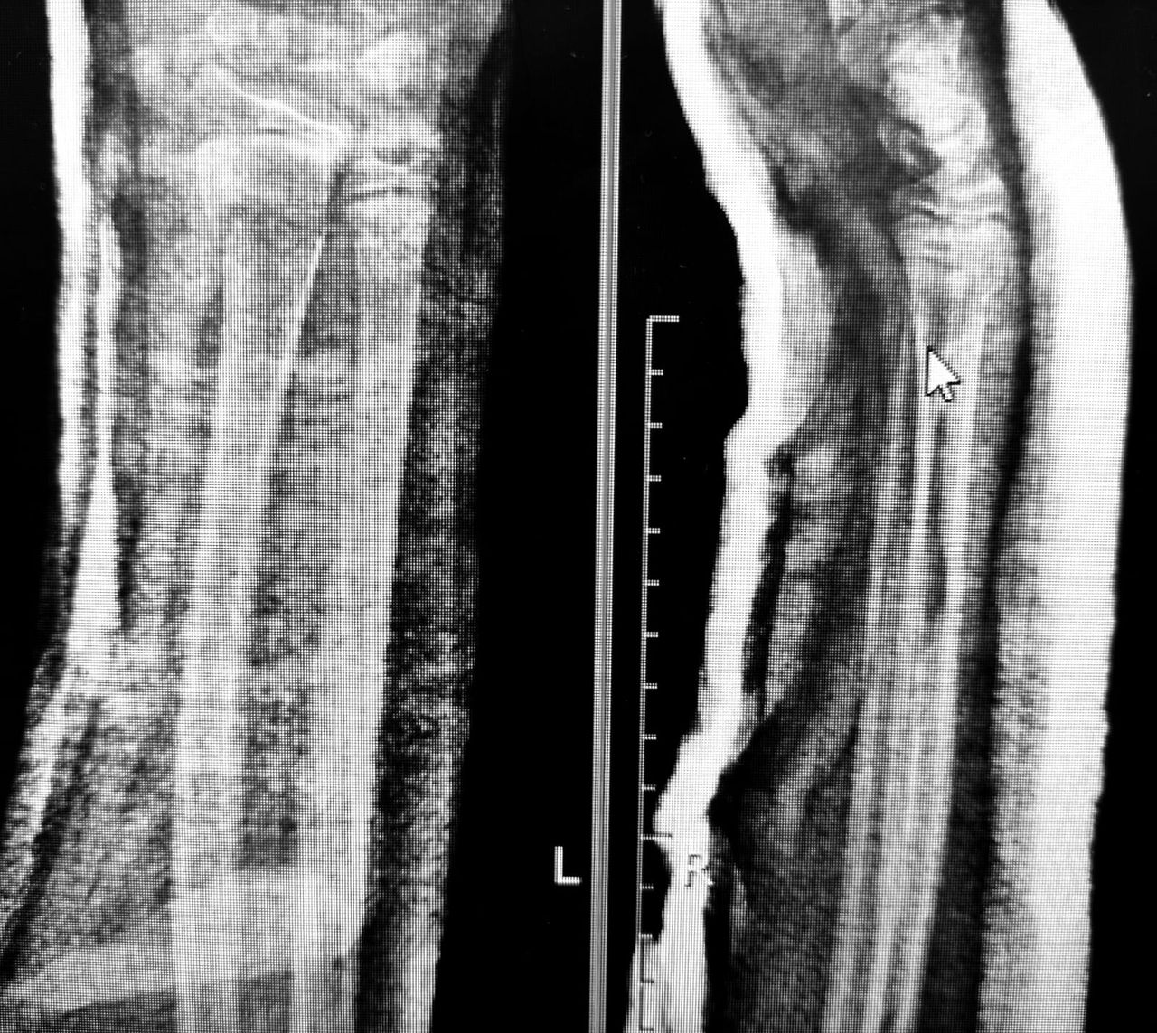 Luis Angel Moreno Espinoza-12