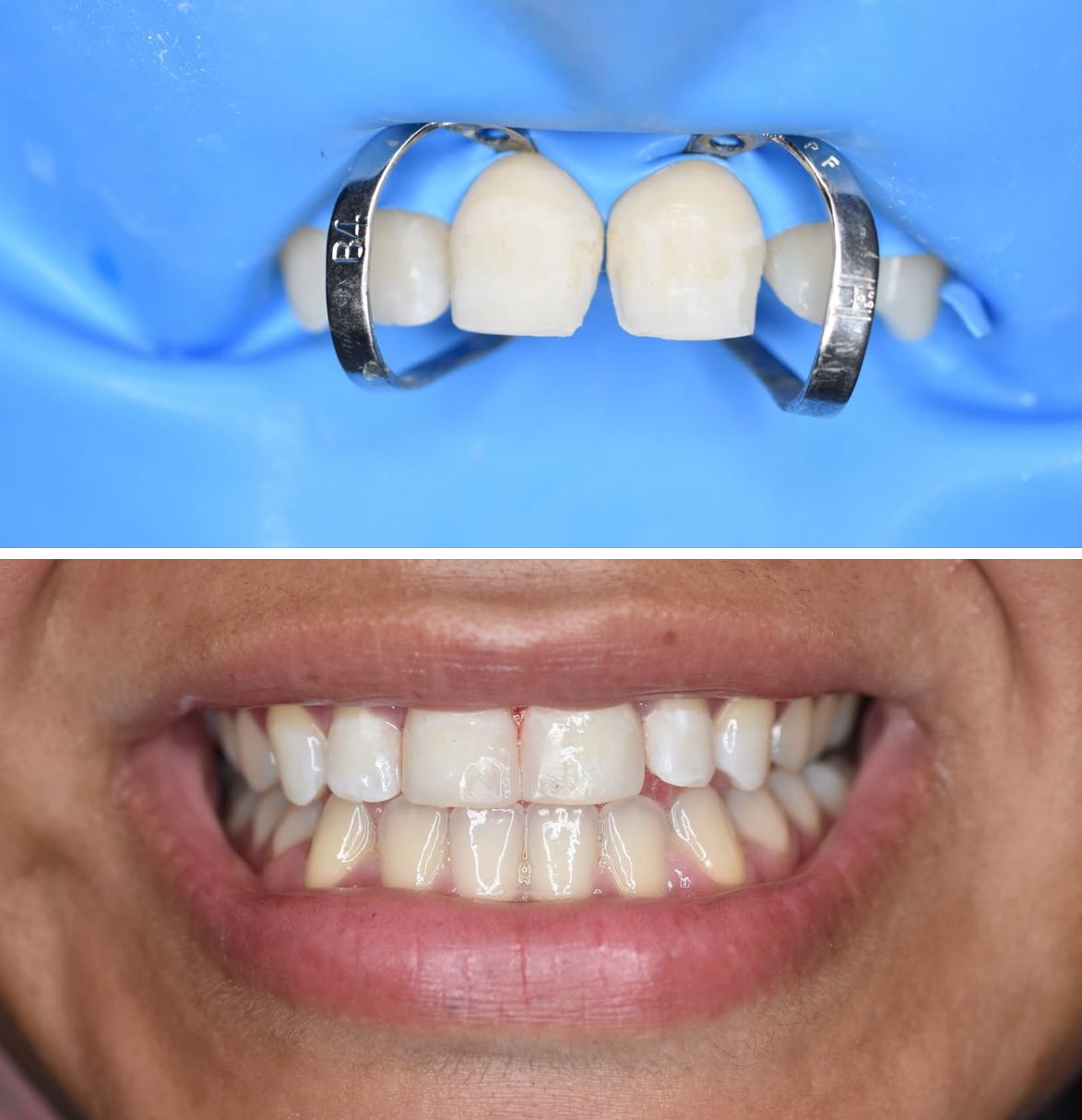 Maxwell Alejandro Moran Gonzalez-12