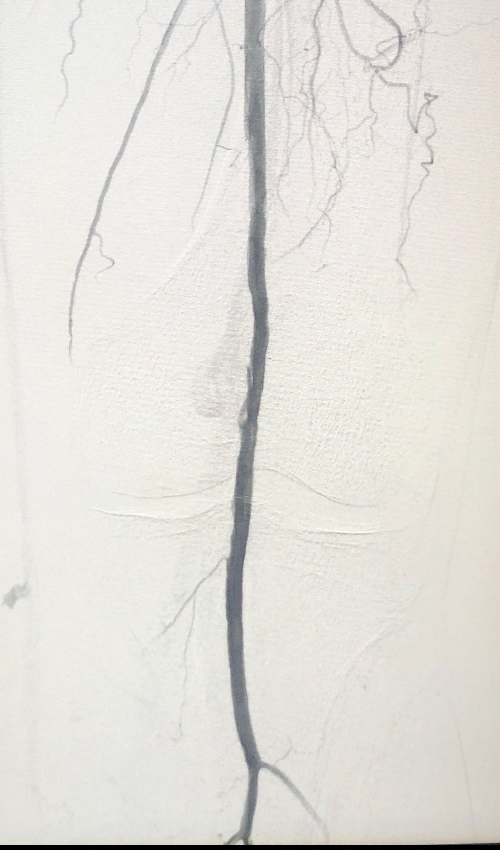 Miguel Abraham Lara Perez-9