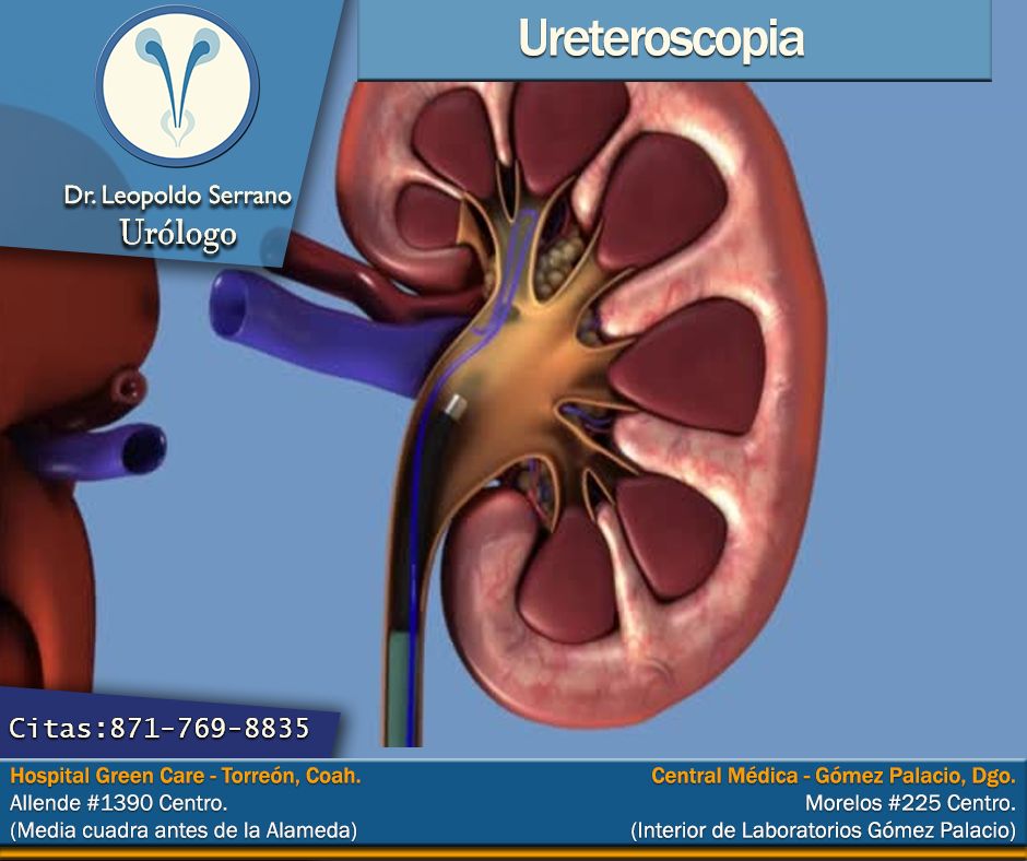 Erik Leopoldo Serrano Ortega-21