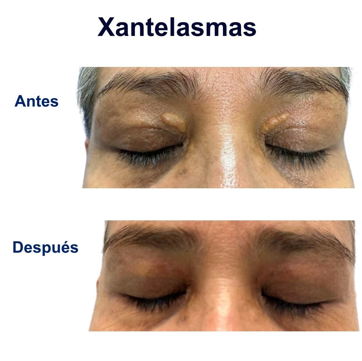 Itzel Anayn Flores Reyes-30