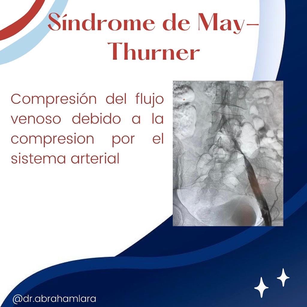 Miguel Abraham Lara Perez-21