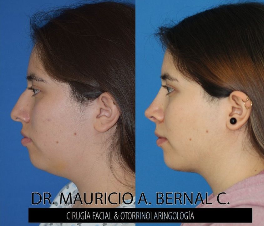 Mauricio Alejandro Bernal Carreon-29