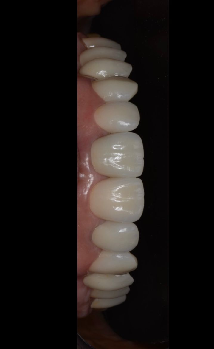 Sergio Bencomo Angulo-7