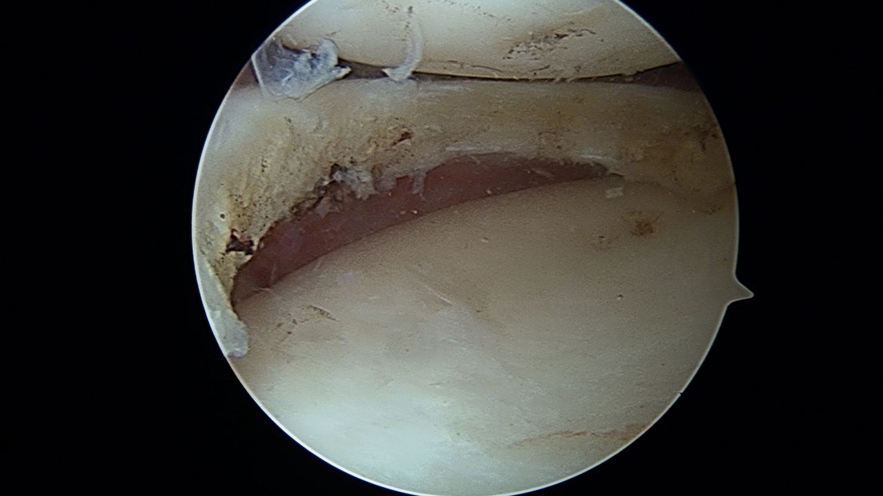 José Antonio Algarín Reyes-36