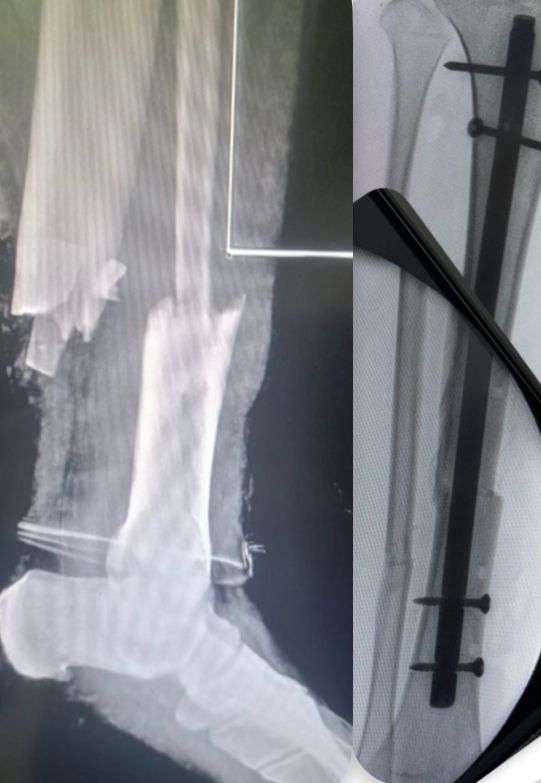 Jorge Antonio Acevedo Valdes-8