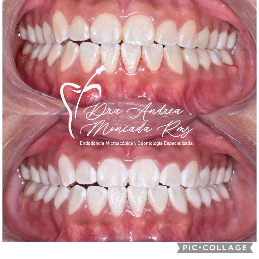 Andrea Moncada Rmz-8