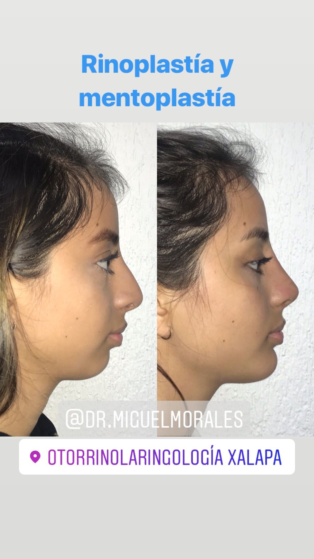 Miguel Ángel Morales Zárate-13