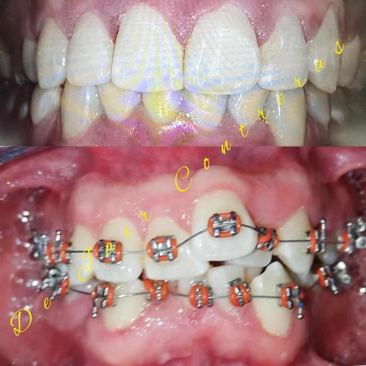 Jair Contreras García-9