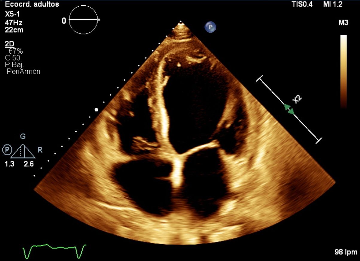 Heriberto Pruneda Ayala-5