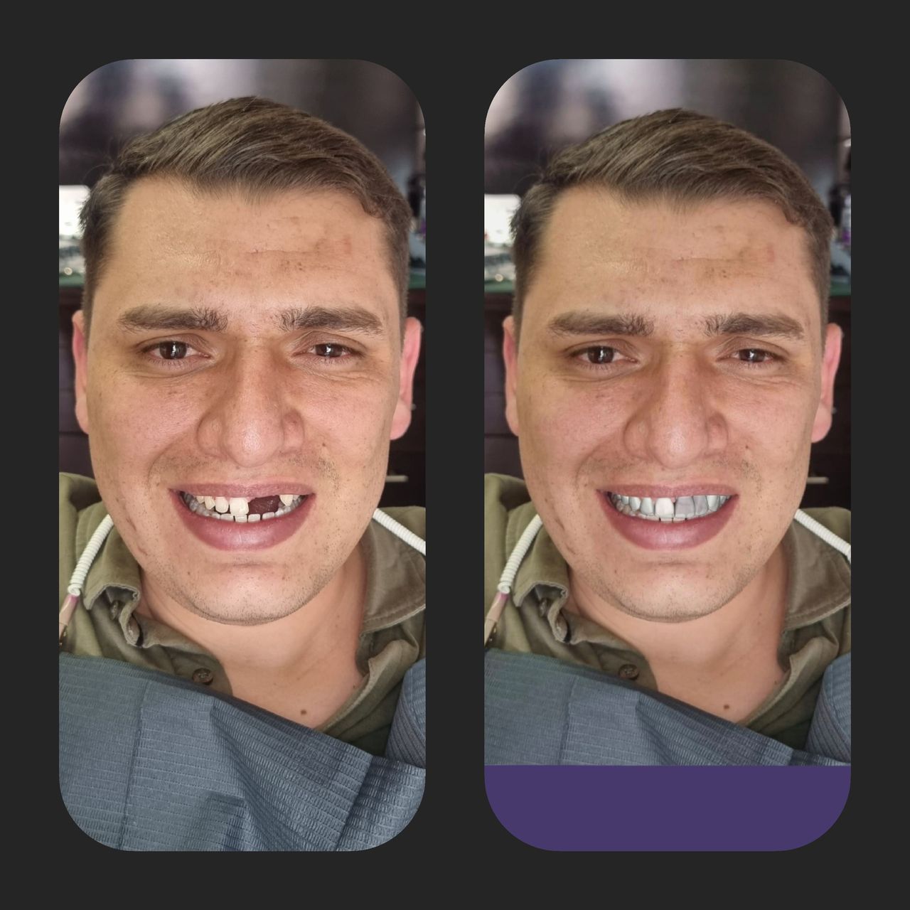 Alejandro Caballero P.-13