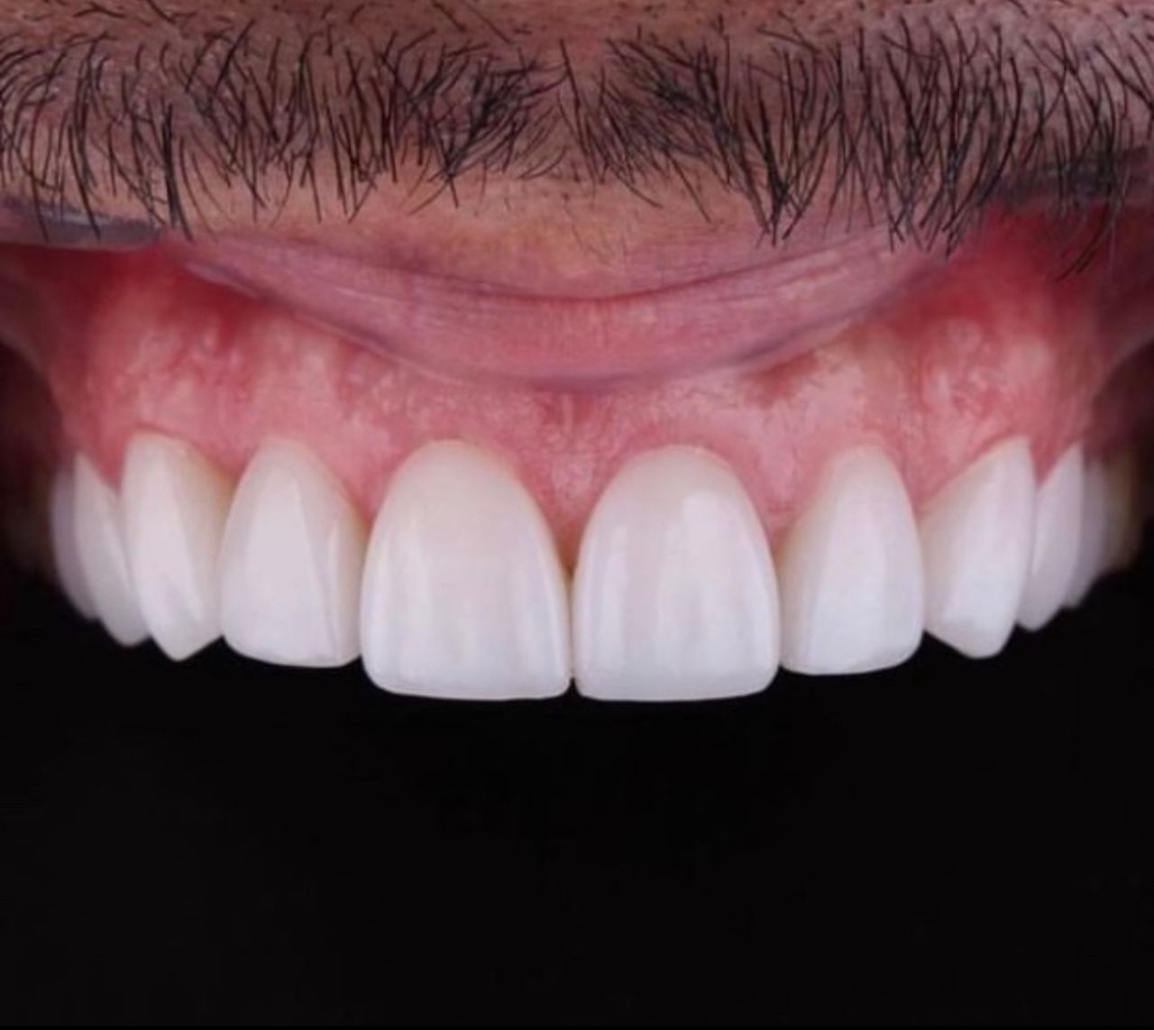 Ulises Alvarado Rodríguez-2