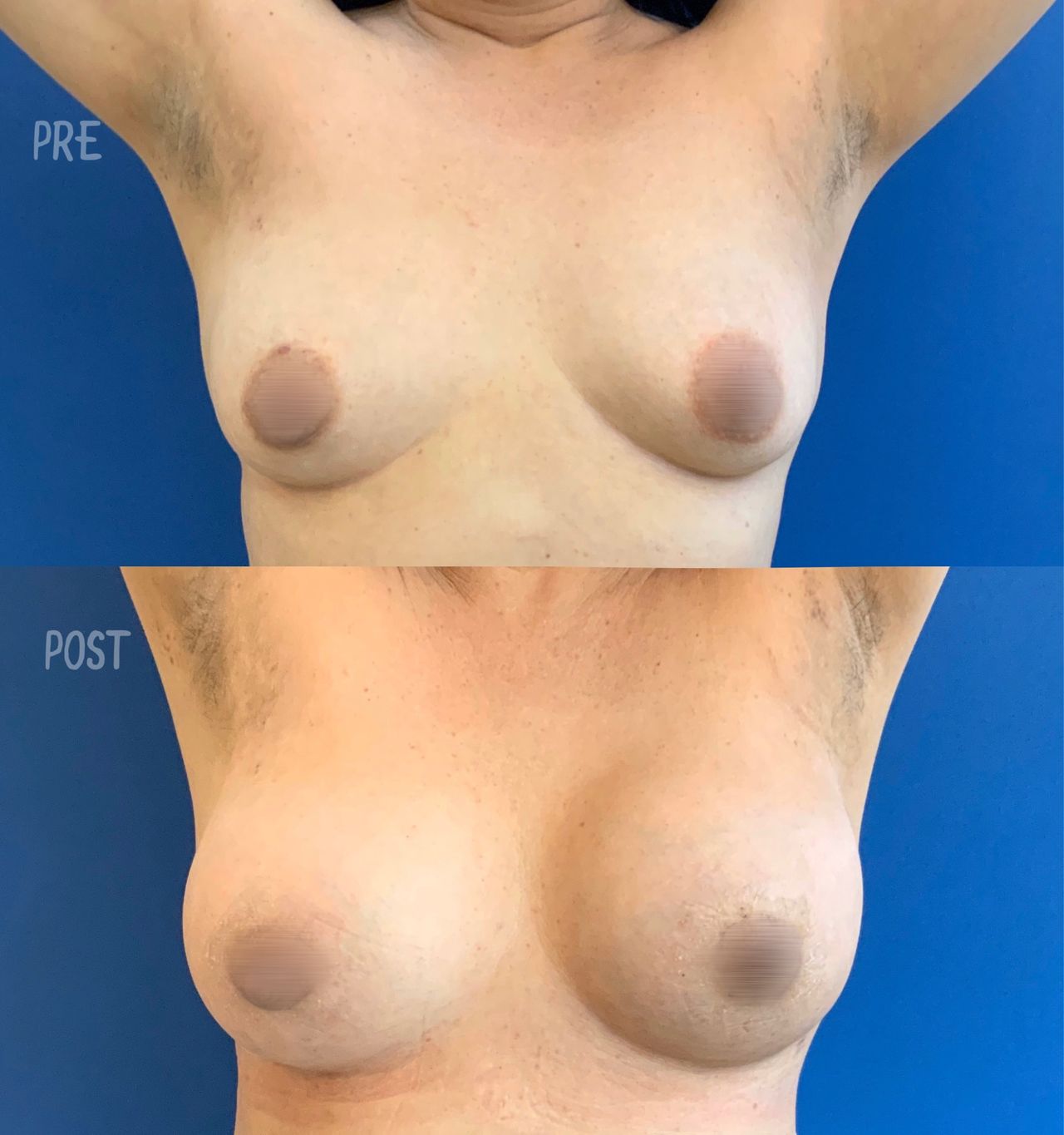 Giuseppe Tanzillo-66